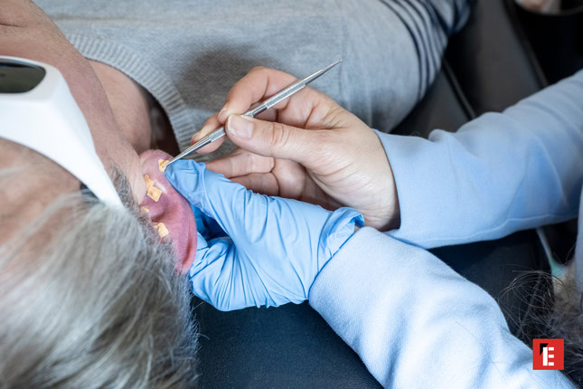 franchise laser happy 65