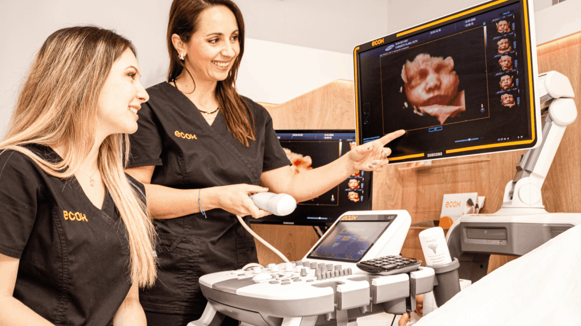 mujeres haciendo ecografía 3d bebé en ecox
