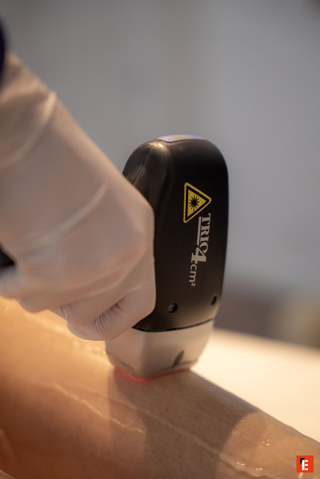 Franchise Laser 26 4