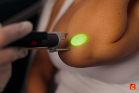 franchise laser skin 1