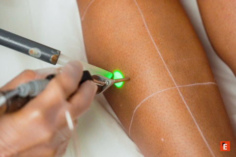 franchise laser skin 10