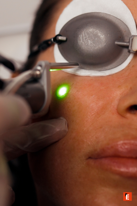 franchise laser skin 12