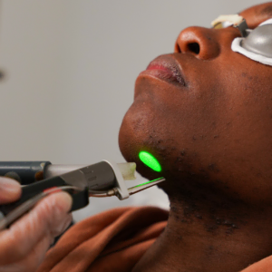 franchise laser skin 2