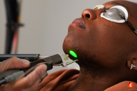 franchise laser skin 2