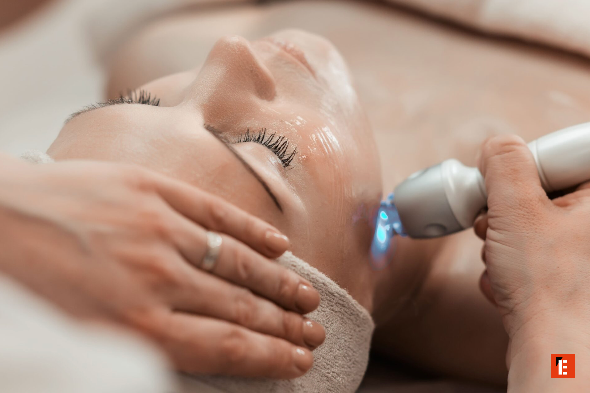 franchise laser skin 3