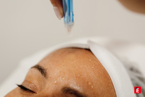 Épilation laser en institut de beauté