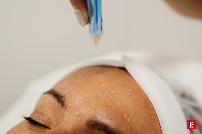 Épilation laser en institut de beauté