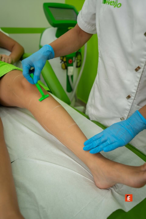 rasatura professionale della gamba in clinica
