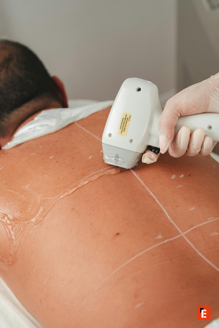 soin esthétique du dos par appareil professionnel