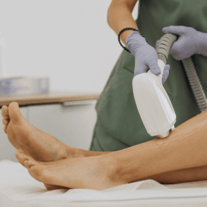 depilación láser de piernas en clínica profesional