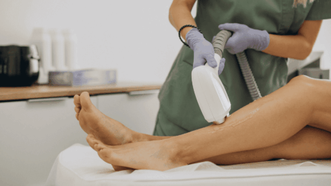 depilación láser de piernas en clínica profesional