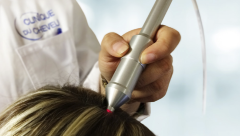 traitement laser précis du cuir chevelu en clinique