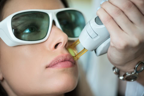 Épilation laser du visage en institut médical